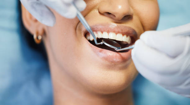 Best Broken or Cracked Tooth Emergency Dentist in Boonville, NC