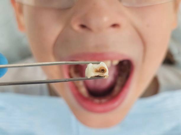 Best Emergency Dental Services for Seniors in Boonville, NC