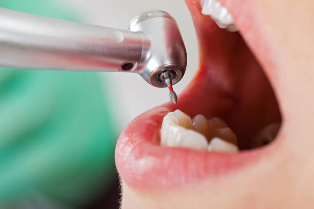 Best Urgent Dental Care for Toothache in Boonville, NC
